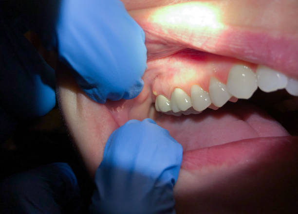 Best Emergency Dentist for Special Needs Patients in Moultrie, GA