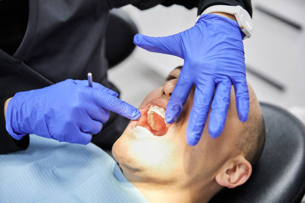 Best Emergency Dentist for Lost Fillings or Crowns in Moultrie, GA
